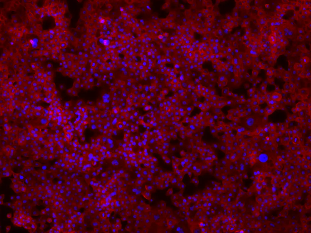 Microscopy of a tumor spheroid cultured on a CanChip device