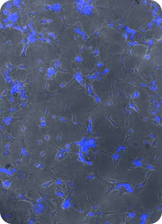 Microscopy of a tumor spheroid cultured on a CanChip device